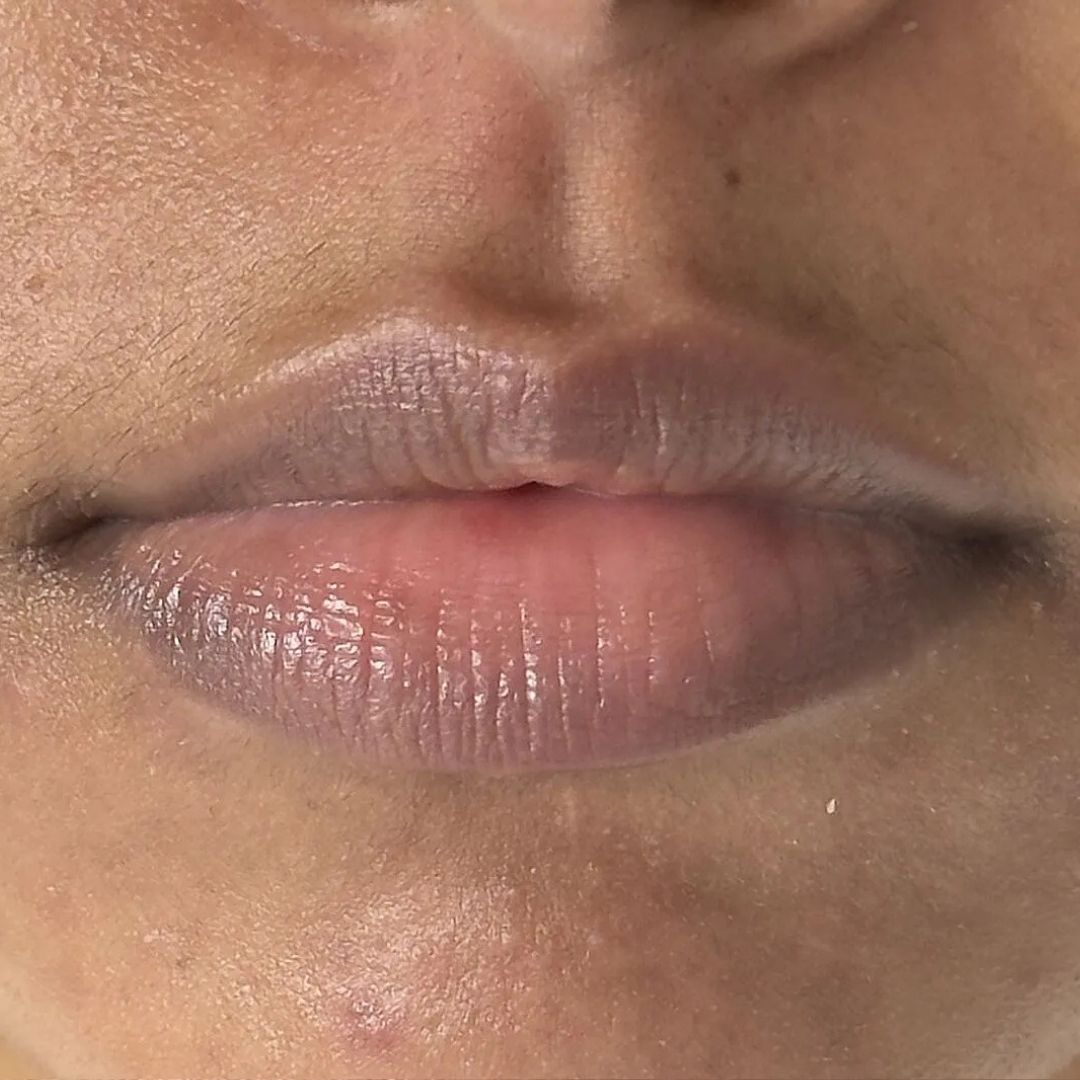 Before using frank body Barrier Protect Lip Treatment: dry, pale lips with visible flaking.