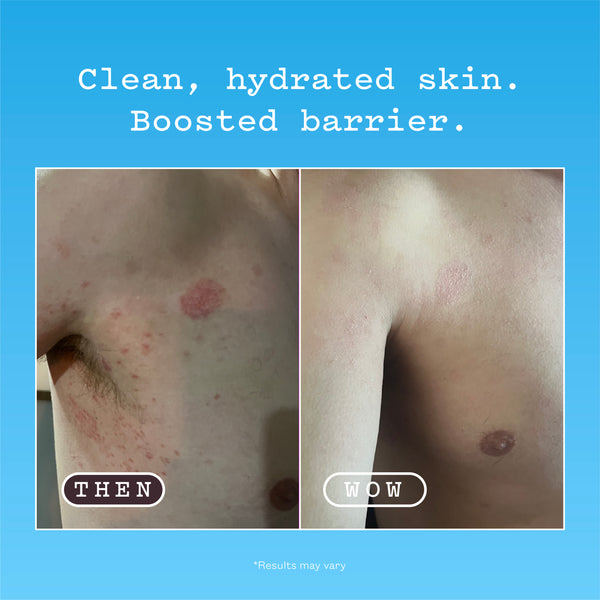 Ceramide Barrier Body Wash before and after, headed Clean, hydrated skin. Boosted barrier. Left panel labelled THEN is the before: dry, flaking skin on the upper arm. Right panel labelled WOW is the after: the same arm looking smooth and hydrated. Results may vary.