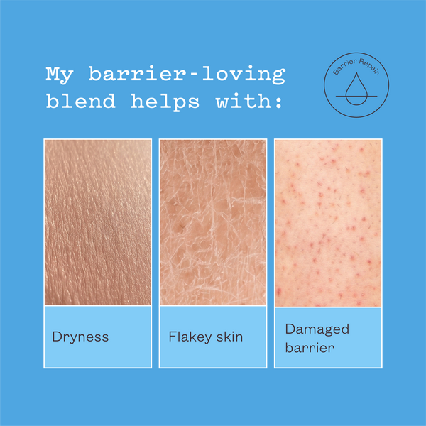 frank body graphic with three skin close-ups. Text reads: My barrier-loving blend helps with dryness, flaky skin, damaged barrier.